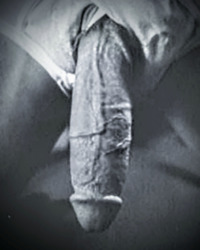 photo-thumb